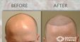 Dr. William Yates. Hair Restoration and MedSpa