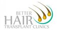 Better Hair Transplant Clinics - Bury