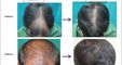 Dermasculpt Skin and Hair Clinic