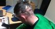 Stockport Hair Loss Clinic