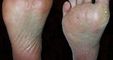The Harley Medical Foot and Nail Laser Clinic: Marion Yau