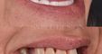 A1 Smile Design
