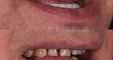 A1 Smile Design