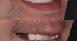 A1 Smile Design