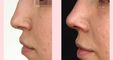 The Nose Aesthetic Clinic - Dr. Cem Altindag