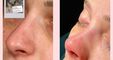 The Nose Aesthetic Clinic - Dr. Cem Altindag