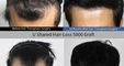 Moaman Hair Transplant Clinic