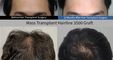 Moaman Hair Transplant Clinic