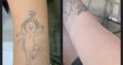 PHU TON - Laser Tattoo Removal