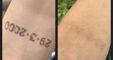 PHU TON - Laser Tattoo Removal