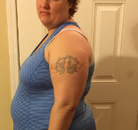 Bandingkan Sebelum & Sesudah Foto Gastric Sleeve