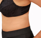 Bandingkan Sebelum & Sesudah Foto Gastric Sleeve