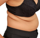 Bandingkan Sebelum & Sesudah Foto Gastric Sleeve