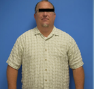 Bandingkan Sebelum & Sesudah Foto Gastric Sleeve