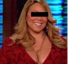 Bandingkan Sebelum & Sesudah Foto Gastric Sleeve