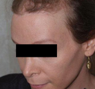  Bandingkan Sebelum & Sesudah Foto Operasi Penggantian Kelamin (Laki-Laki ke Perempuan)