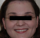  Bandingkan Sebelum & Sesudah Foto Operasi Penggantian Kelamin (Laki-Laki ke Perempuan)