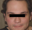  Bandingkan Sebelum & Sesudah Foto Operasi Penggantian Kelamin (Laki-Laki ke Perempuan)