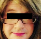  Bandingkan Sebelum & Sesudah Foto Operasi Penggantian Kelamin (Laki-Laki ke Perempuan)