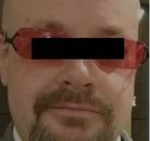  Bandingkan Sebelum & Sesudah Foto Operasi Penggantian Kelamin (Laki-Laki ke Perempuan)