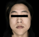  Bandingkan Sebelum & Sesudah Foto Operasi Penggantian Kelamin (Laki-Laki ke Perempuan)