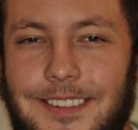 Bandingkan Sebelum & Sesudah Foto Implan Gigi