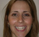 Bandingkan Sebelum & Sesudah Foto Implan Gigi