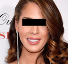  Bandingkan Sebelum & Sesudah Foto Operasi Penggantian Kelamin (Laki-Laki ke Perempuan)