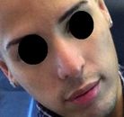  Bandingkan Sebelum & Sesudah Foto Operasi Penggantian Kelamin (Laki-Laki ke Perempuan)