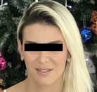  Bandingkan Sebelum & Sesudah Foto Operasi Feminisasi Wajah (FFS)