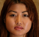  Bandingkan Sebelum & Sesudah Foto Pembuatan Kelopak Mata Ganda