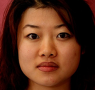  Bandingkan Sebelum & Sesudah Foto Pembuatan Kelopak Mata Ganda