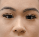  Bandingkan Sebelum & Sesudah Foto Pembuatan Kelopak Mata Ganda