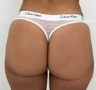 So sánh Ảnh Trước và Sau của Nâng mông