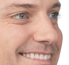  Bandingkan Sebelum & Sesudah Foto Suntik Botox