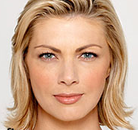  Bandingkan Sebelum & Sesudah Foto Suntik Botox