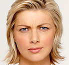  Bandingkan Sebelum & Sesudah Foto Suntik Botox