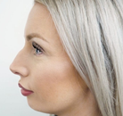  Bandingkan Sebelum & Sesudah Foto Suntik Botox