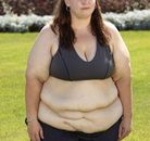 Bandingkan Sebelum & Sesudah Foto Pengobatan Gastric Balloon