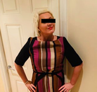 Bandingkan Sebelum & Sesudah Foto Pengobatan Gastric Balloon