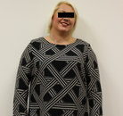 Bandingkan Sebelum & Sesudah Foto Pengobatan Gastric Balloon