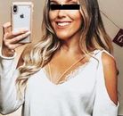 Bandingkan Sebelum & Sesudah Foto Pengobatan Gastric Balloon