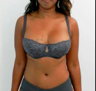  Bandingkan Sebelum & Sesudah Foto Mommy Makeover