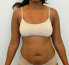  Bandingkan Sebelum & Sesudah Foto Mommy Makeover