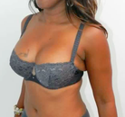  Bandingkan Sebelum & Sesudah Foto Mommy Makeover