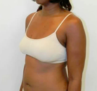  Bandingkan Sebelum & Sesudah Foto Mommy Makeover