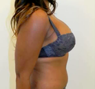  Bandingkan Sebelum & Sesudah Foto Mommy Makeover