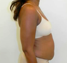  Bandingkan Sebelum & Sesudah Foto Mommy Makeover