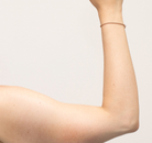  Bandingkan Sebelum & Sesudah Foto Arm Lift