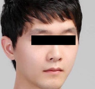  Bandingkan Sebelum & Sesudah Foto Pembentukan Rahang